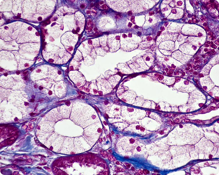 3D Kidney Printing image